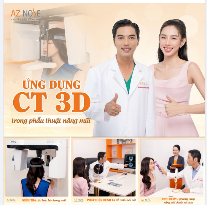 NÂNG MŨI AN TOÀN CÙNG CÔNG NGHỆ CHỤP CT 3D