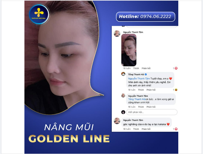 ”GÓC NGHIÊNG CỦA EM DO BÁC SĨ TỐNG HẢI TẠO”
