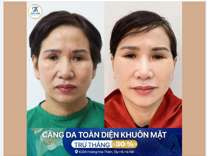 TỪNG BƯỚC TÌM LẠI THANH XUÂN