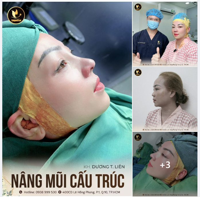 60 PHÚT NÂNG MŨI CẤU TRÚC MŨI THẤP TẸT HÓA MŨI CAO SANG