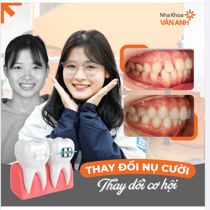 THAY ĐỔI NỤ CƯỜI - THAY ĐỔI CƠ HỘI 