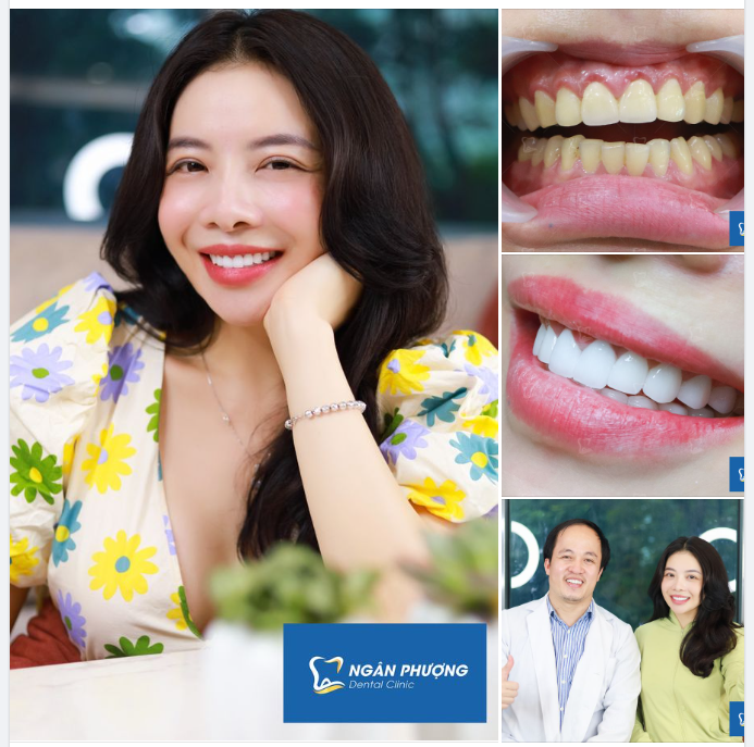 Chẳng bằng ngừng lại ngắm nụ cười này 1 giây