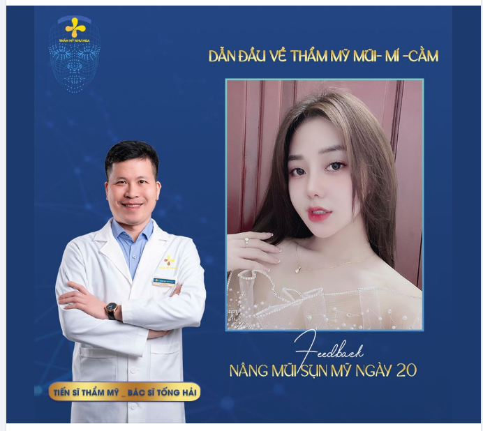 Dáng mũi ngày thứ 20 của bạn gái sinh năm 2002.