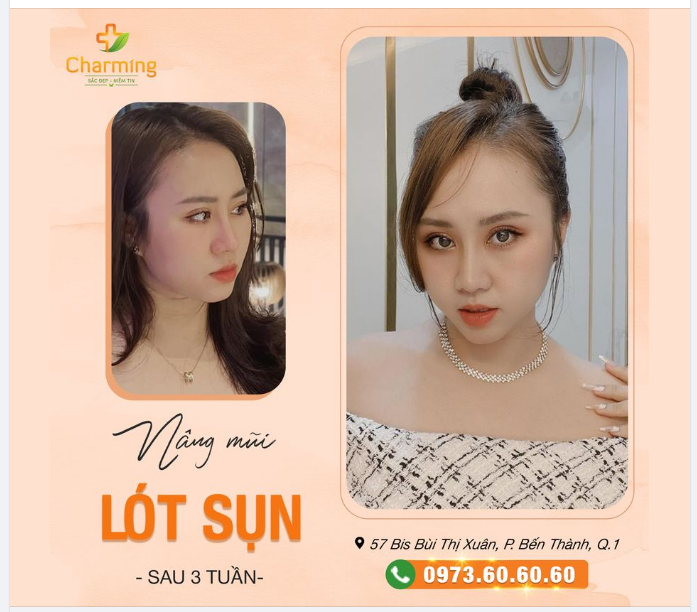 Môi xinh, đôi mắt rạng ngời. Lại thêm mũi đẹp, vạn người khen em
