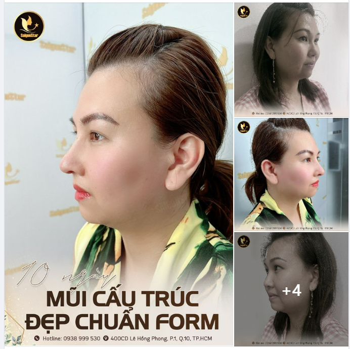 Chiêm ngưỡng ngay dáng mũi chiếm spotlight của chị khách Hồng Anh (Việt kiều Mỹ)