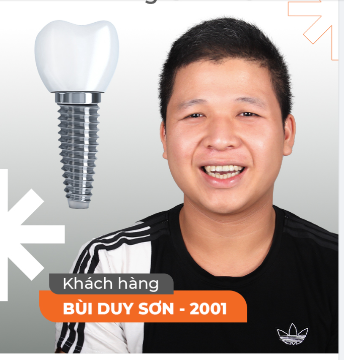 IMPLANT HIỆN ĐẠI - TRỒNG 1 LẦN DÙNG CẢ ĐỜI