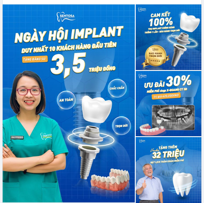 ƯU ĐÃI TRỒNG RĂNG IMPLANT NHÂN DỊP LỄ LỚN 30/04 - 01/5