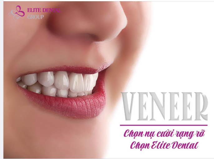 Chọn nụ cười rạng rỡ tự nhiên - chọn Elite Dental