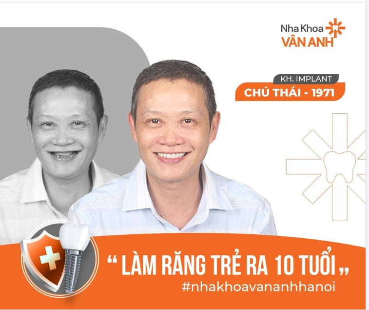LÀM IMPLANT TRẺ RA 10 TUỔI