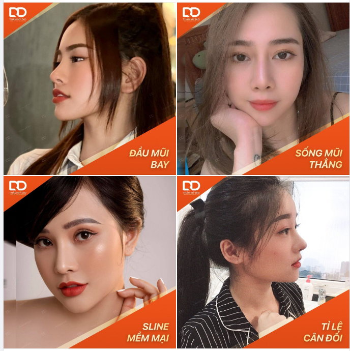 NÂNG MŨI BẢO HÀNH TRỌN ĐỜI - KHÔNG LO CHI PHÍ