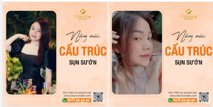 Góc nghiêng em đã xinh xinh. Lại thêm chính diện lung linh tuyệt vời