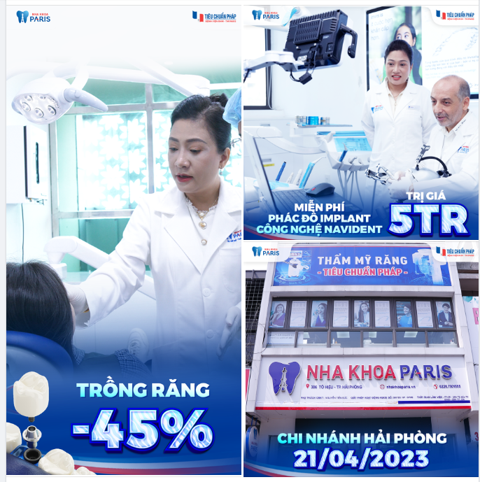 TRỒNG RĂNG -45% NHÂN NGÀY HỘI THĂM KHÁM CÙNG CHUYÊN GIA