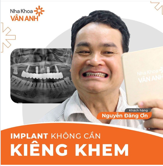LÀM IMPLANT CÓ CẦN KIÊNG KHEM?
