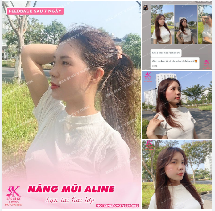 CHUYÊN MỤC FEEDBACK MŨI XINH