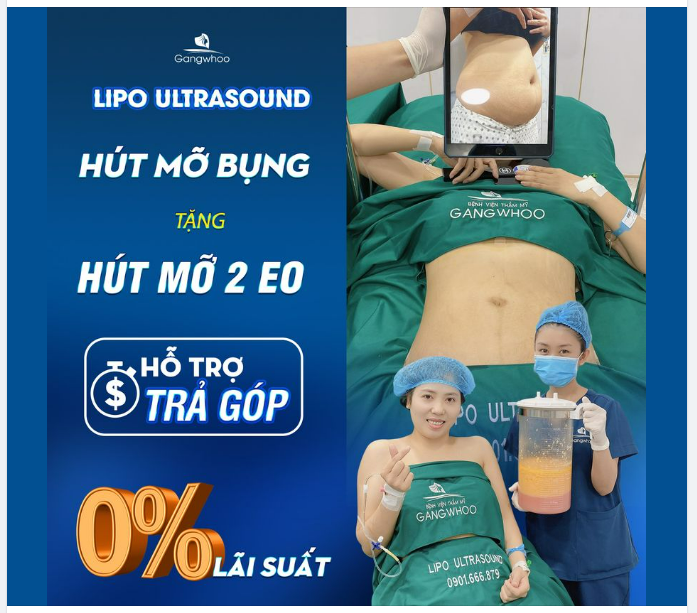 LIPO ULTRASOUND VÀ KHẢ NĂNG GIẢM 6 - 8KG CHỈ SAU 60 PHÚT