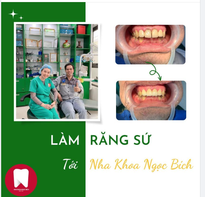 LÀM RĂNG SỨ CẦN CHỌN NHA KHOA UY TÍN