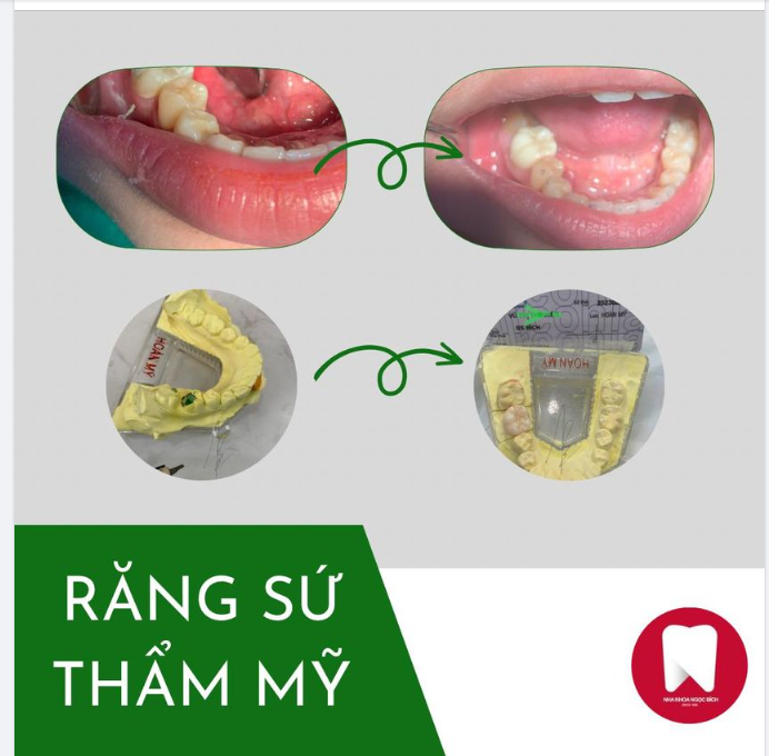 LỰA CHỌN CHI PHÍ HỢP LÍ CHO SINH VIÊN