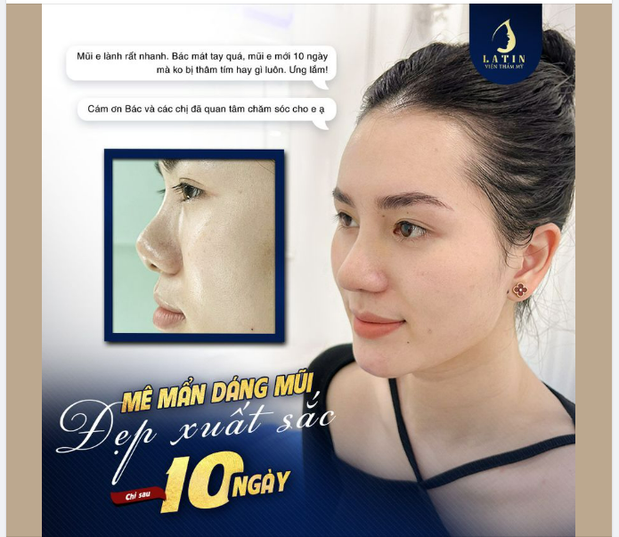MÊ MẨN dáng mũi mới đẹp XUẤT SẮC chỉ sau 10 ngày