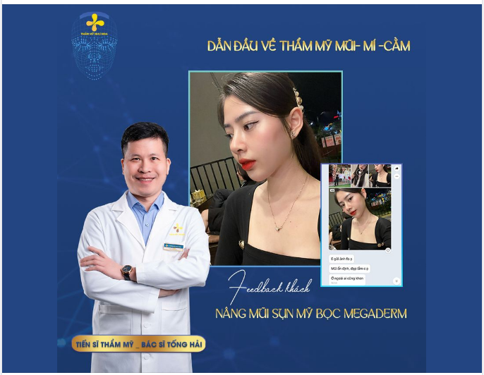 DÁNG MŨI NHÌN TỰ NHIÊN - PHÙ HỢP VỚI GƯƠNG MẶT - KHẮC PHỤC ĐƯỢC KHUYẾT ĐỊNH CỦA DÁNG MŨI CŨ