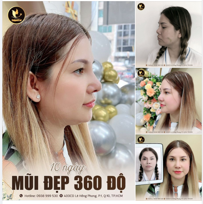 10 NGÀY MŨI ĐẸP 360 ĐỘ