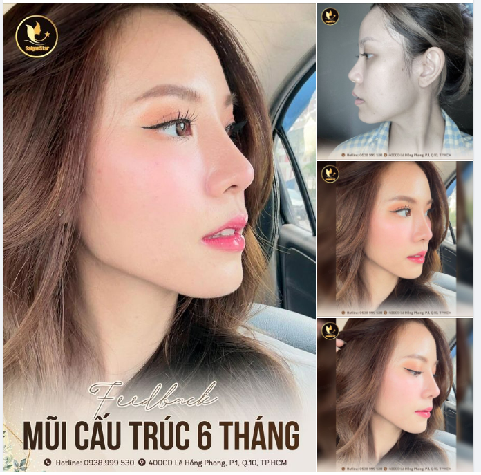 CÙNG LÀ GÓC NGHIÊNG NHƯNG 2 NÉT MẶT