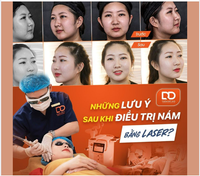 NHỮNG LƯU Ý SAU KHI ĐIỀU TRỊ NÁM BẰNG LASER