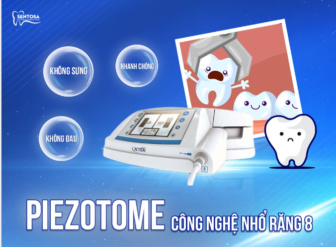 NHỔ RĂNG KHÔN VỚI CÔNG NGHỆ PIEZOTOME SIÊU HIỆN ĐẠI VÀ NHẸ NHÀNG