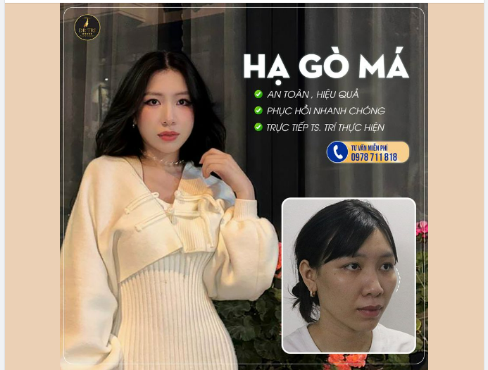 HẠ GÒ MÁ - XÓA BỎ NỖI LO MẶT TO BỰ
