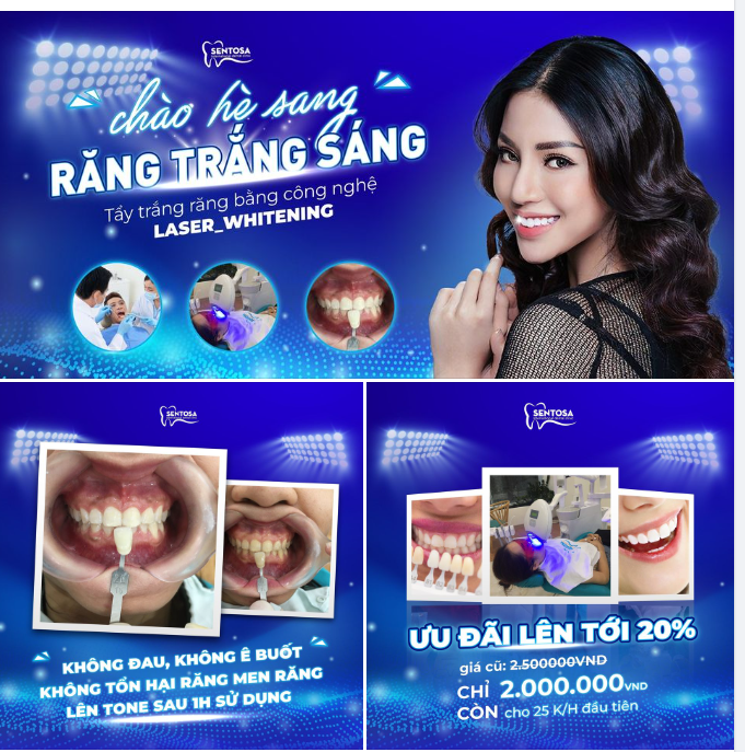 CHÀO HÈ SANG- RĂNG TRẮNG SÁNG CÙNG SENTOSA