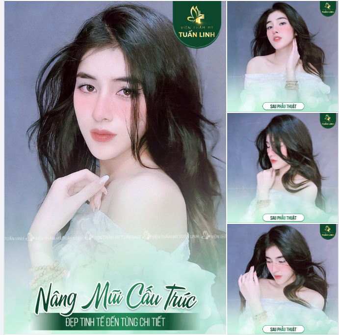 NÂNG MŨI CẤU TRÚC - ĐẸP TINH TẾ ĐẾN TỪNG CHI TIẾT!!