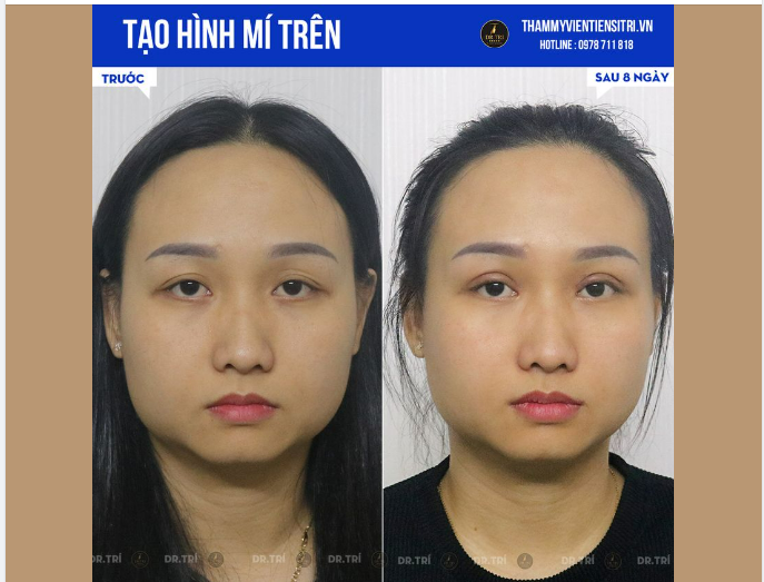 BẬT MÍ HÌNH ĐẸP CỦA CHỊ KHÁCH