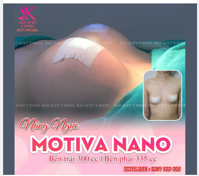 Khoe cả nhà bộ Ngực tâm huyết Kỳ vừa hoàn thành cho bạn khách tại Nha Trang