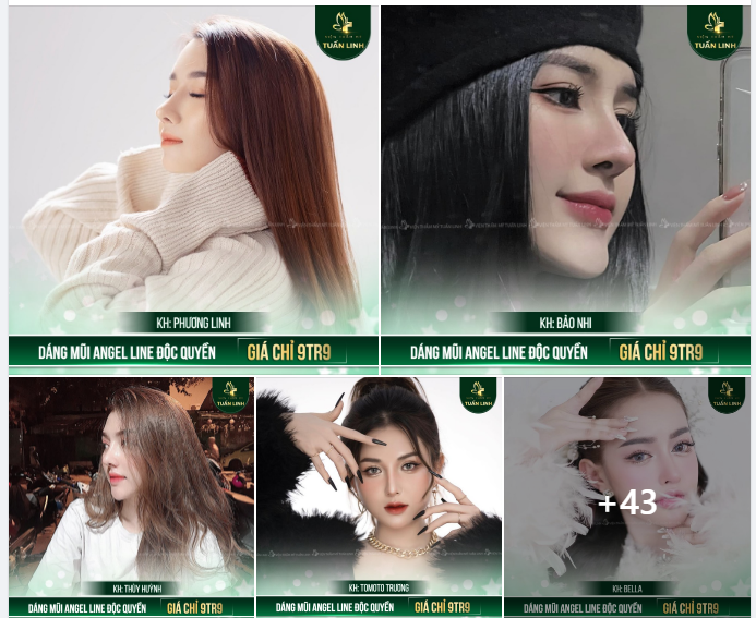 Dáng mũi Angel Line độc quyền tại Tuấn Linh giá chỉ từ 9tr9 