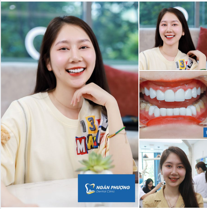 Ϲười thật tươi lên khi đôi môi ta còn đỏ mọng  Năm tháng ấу quaу lại được không?