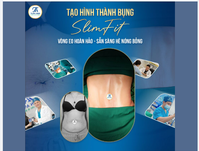 EO THON HÈ NÀY Tạo Hình Thành Bụng SlimFit