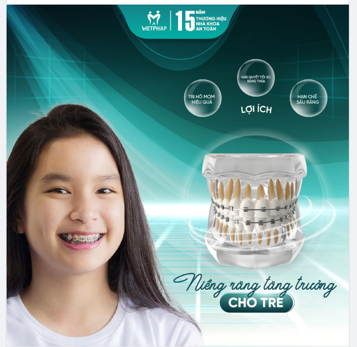 TIỀN CHỈNH NHA CHO TRẺ - GIẢI QUYẾT TRIỆT ĐỂ CÁC BỆNH LÝ RĂNG MIỆNG