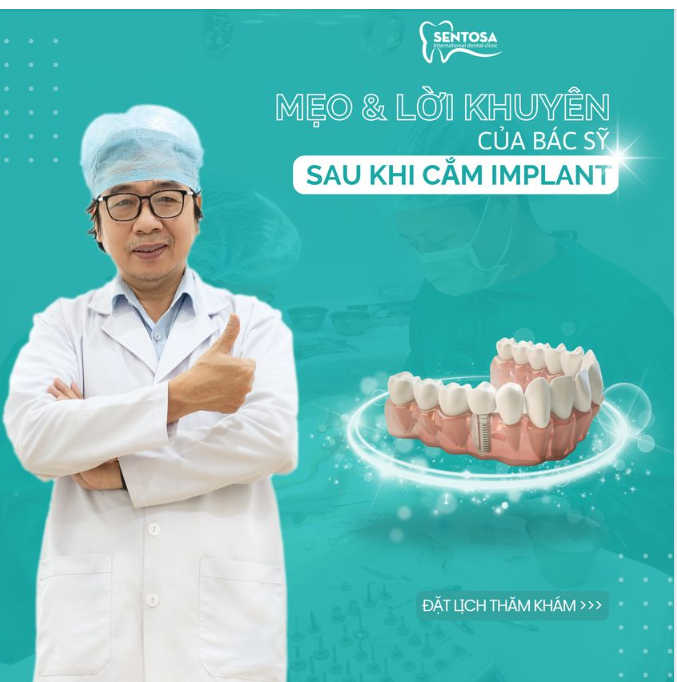 MẸO VÀ LỜI KHUYÊN CỦA BÁC SỸ SAU KHI CẮM IMPLANT
