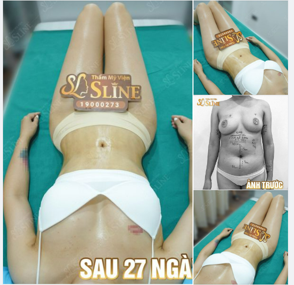 PHẢN HỒI THỰC TẾ - VỚI THỜI GIAN ẤN TƯỢNG