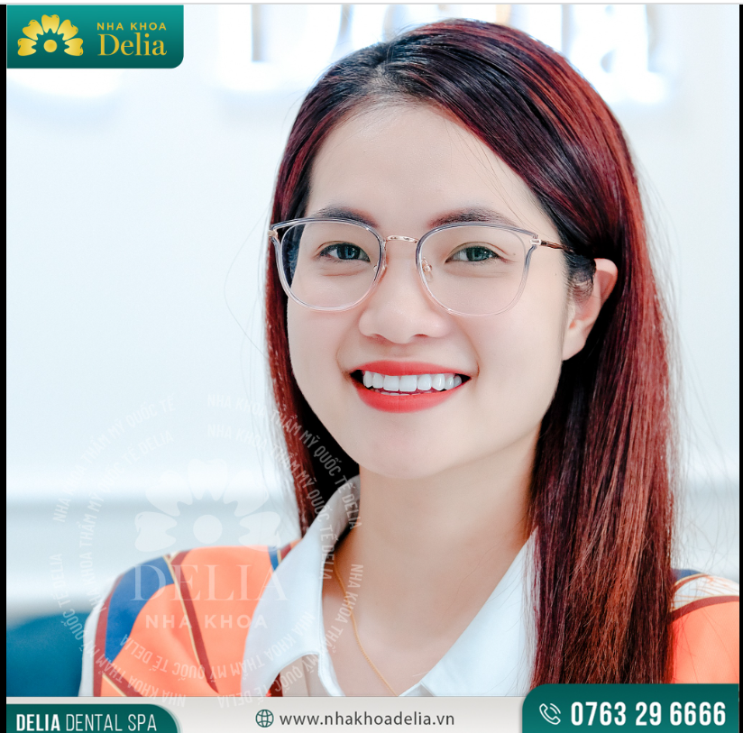 Cảm ơn chị Thu Hoài đã tin yêu và lựa chọn nha khoa Delia là nơi chăm sóc nụ cười của mình.