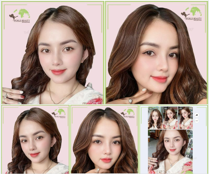 "Trẻ hóa" gương mặt sau n.âng mũi là có thật. Qúy Cô khen hết lời kèm với vài thước ảnh xinh xắn về Phòng khám: