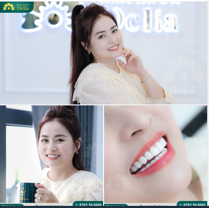 NỤ CƯỜI - MÓN TRANG SỨC HOÀN HẢO CHO VẺ ĐẸP QUÝ PHÁI