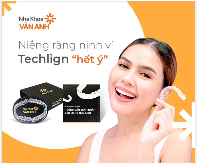 NIỀNG RĂNG NỊNH VÍ - TECHLIGN "HẾT Ý"