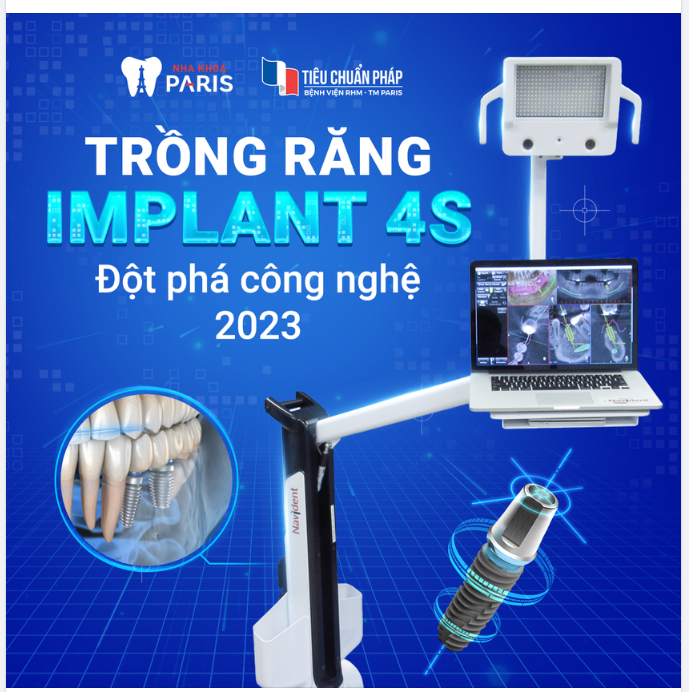 CÔNG NGHỆ TRỒNG RĂNG BẰNG ROBOT ĐỊNH VỊ NAVIDENT - ĐỘT PHÁ 2023