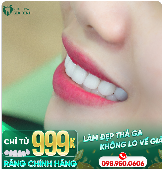 PHẢI LÀM RĂNG THẨM MỸ THÌ BẠN MỚI BIẾT NỤ CƯỜI BẠN ĐẸP THẾ NÀO