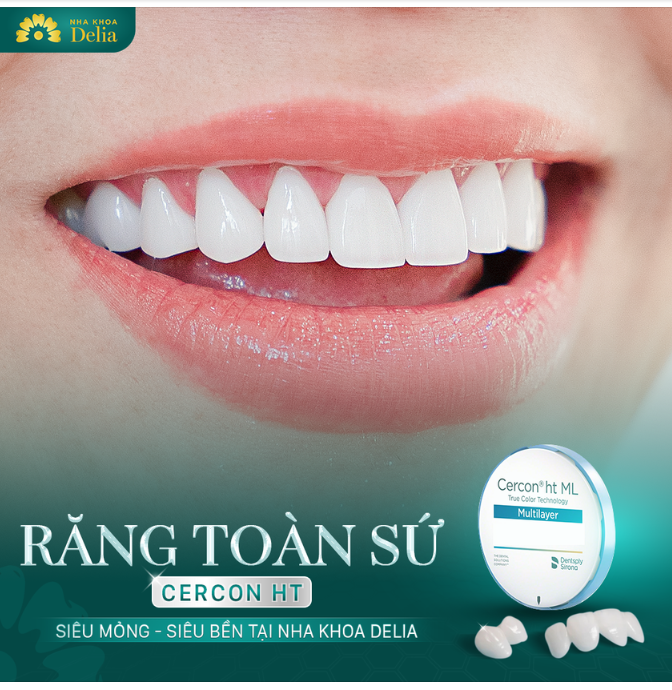 Răng toàn sứ Cercon HT - Mỏng nhẹ - Bền đẹp - An toàn tuyệt đối tại nha khoa Delia