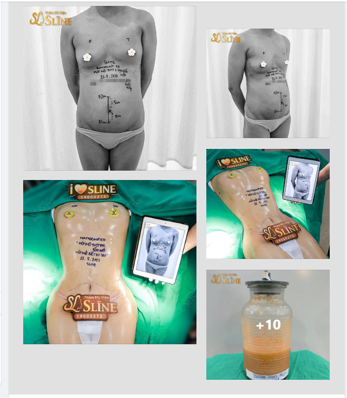 SIÊU COMBO TÁI TẠO BODY Chính xác thì đây là hình ảnh của cùng 1 người.