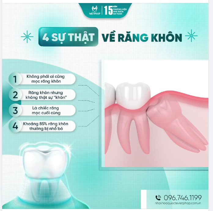 4 SỰ THẬT VỀ RĂNG KHÔN