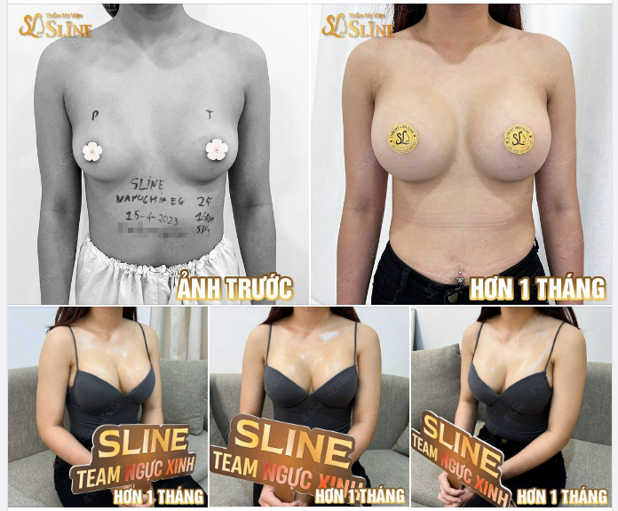 ĐẸP - CÂN ĐỐI  SAU HƠN 1 THÁNG