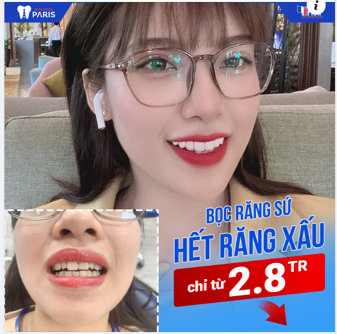 NGƯỜI TRẺ LÀM RĂNG SỨ - CÓ NÊN KHÔNG???
