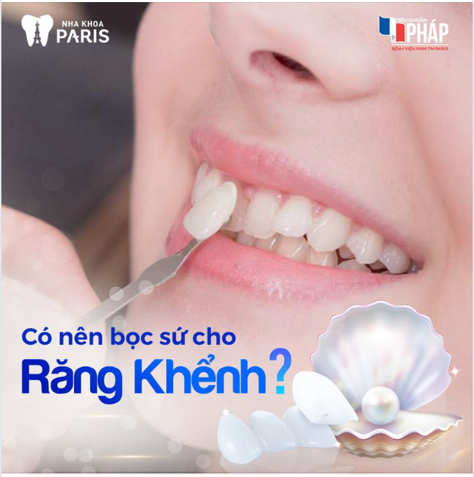 BỌC SỨ RĂNG KHỂNH MANG LẠI NHỮNG LỢI ÍCH GÌ?